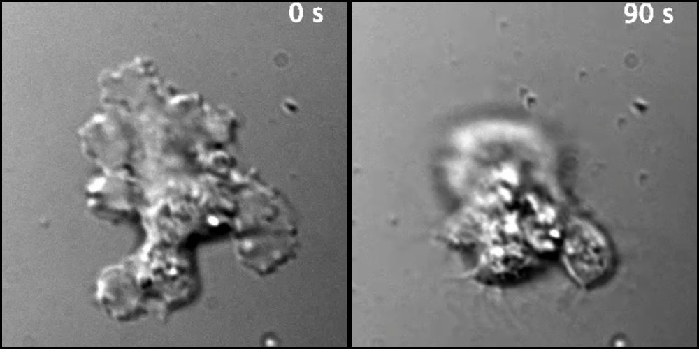 Side-by-side microscope images of a single Incendiamoeba cascadensis cell. The left image shows the amoeba at 0 seconds while at 60°C (140°F). The right image shows the same cell 90 seconds after a 70°C (158°F) heat shock, rounded into a protective cyst.