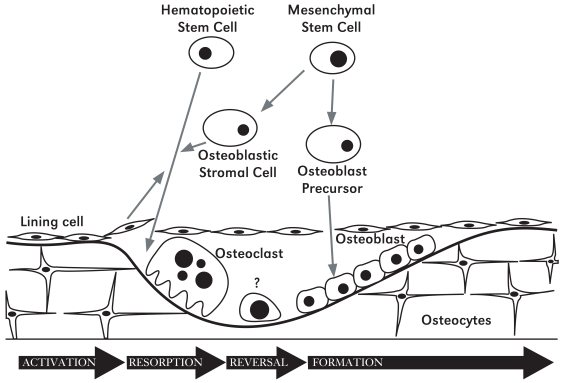 Diagram showing the stages of bone remodeling as osteoclasts remove old bone, followed by osteoblasts depositing new bone and some becoming osteocytes.