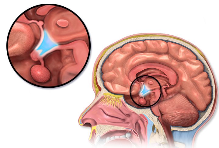 Sagittal illustration of the human head and brain with the hypothalamus highlighted in blue near the base of the brain, plus a magnified inset showing its location in greater detail.