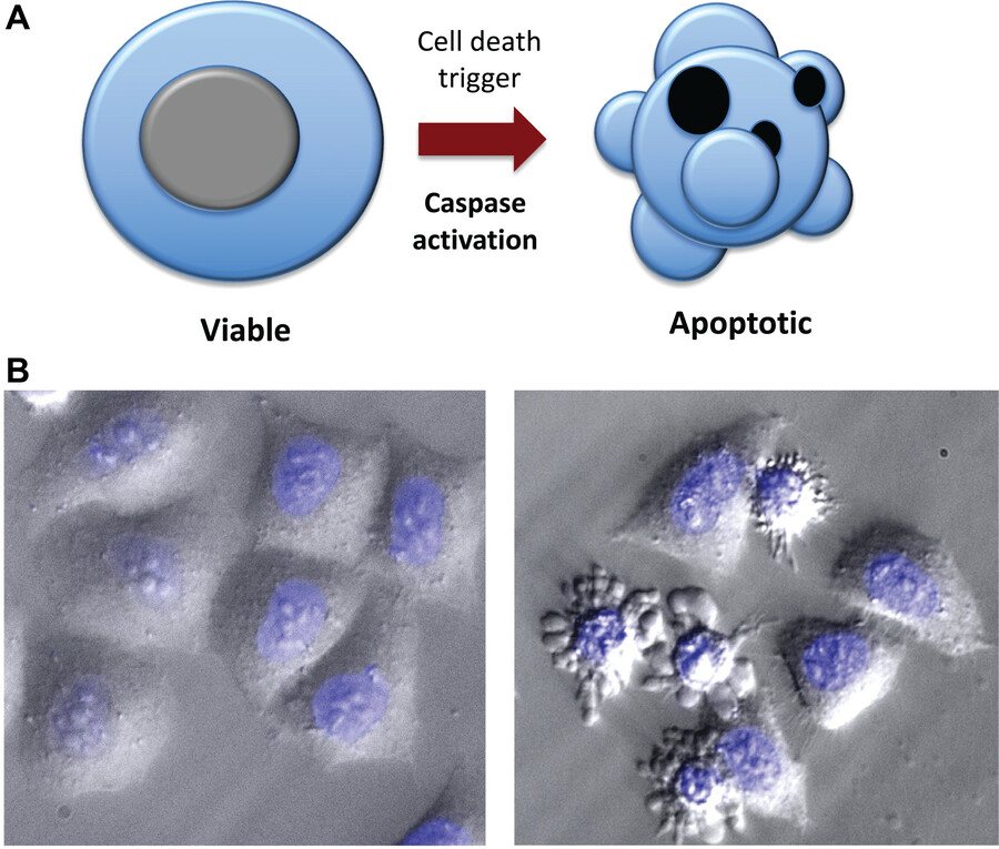 Two-part figure comparing viable and apoptotic cells. A schematic shows a normal rounded cell undergoing caspase activation and becoming a shrunken, irregular apoptotic cell with membrane bulges and fragmented nuclear material. Phase-contrast microscope images below compare healthy cells with cells displaying the characteristic morphology of apoptosis.